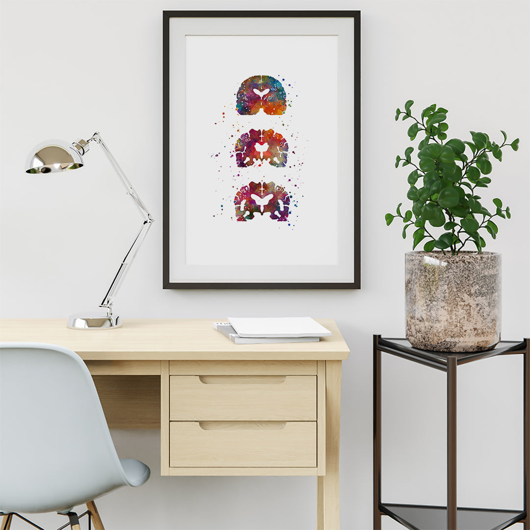 Alzheimers Brain Watercolor Art Print - Neurology Decor