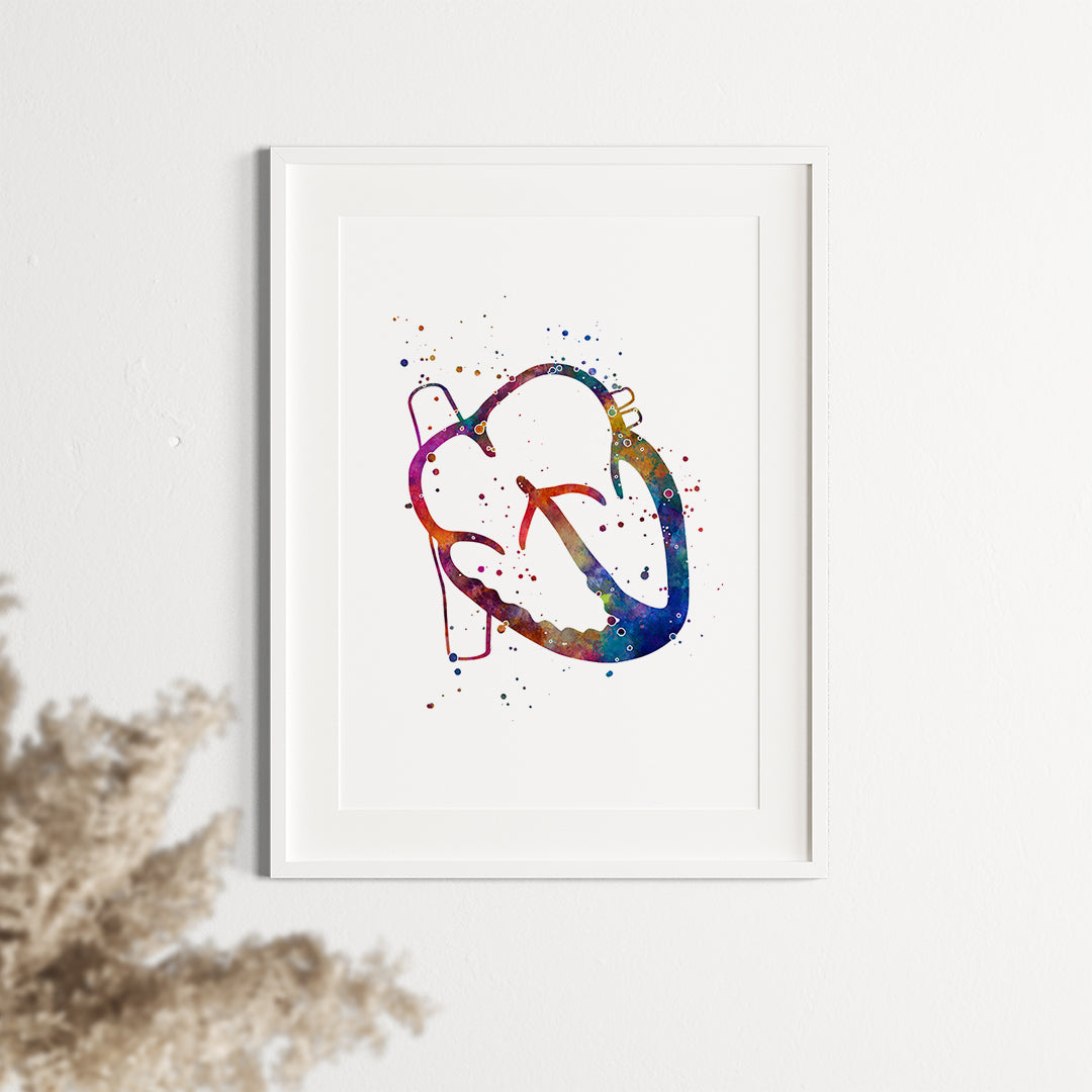 Atrial septal defect anatomy print for educational and professional use.