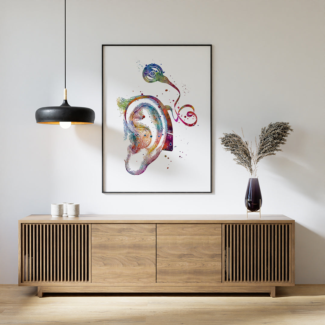 Cochlear implant anatomy art print for hearing loss treatment centers.