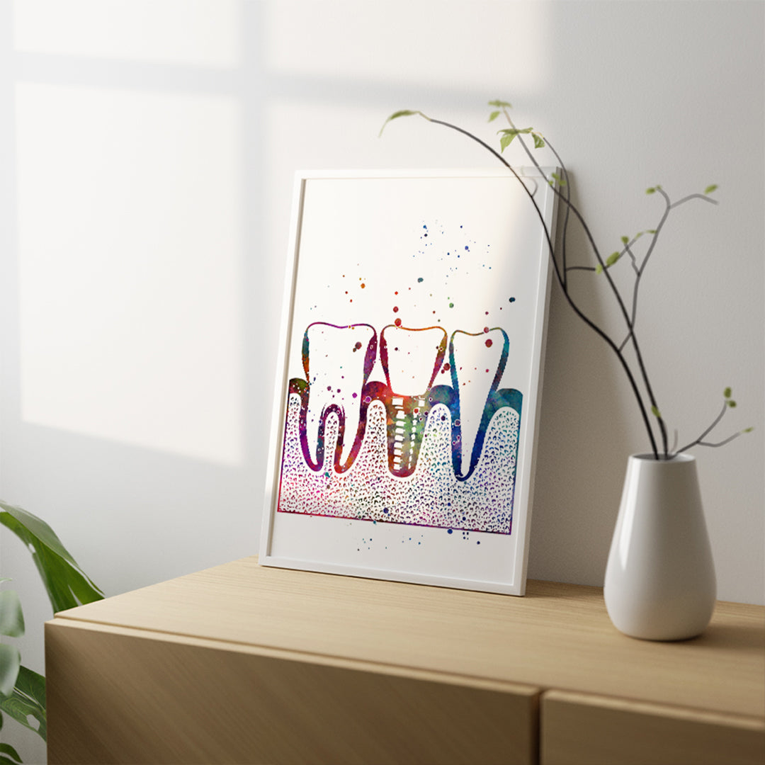 Dental Implant Art Print – Colorful Tooth Wall Decor