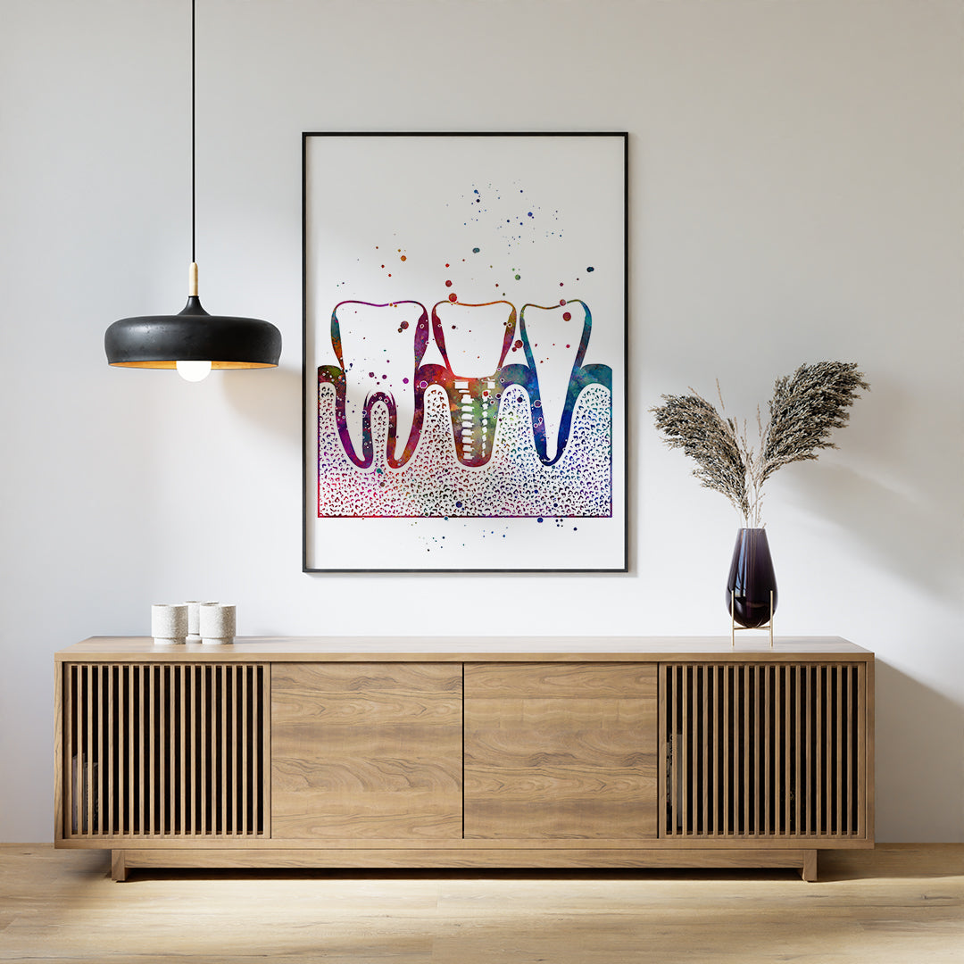 Watercolor print of teeth with a dental implant, ideal for professional dental decor.