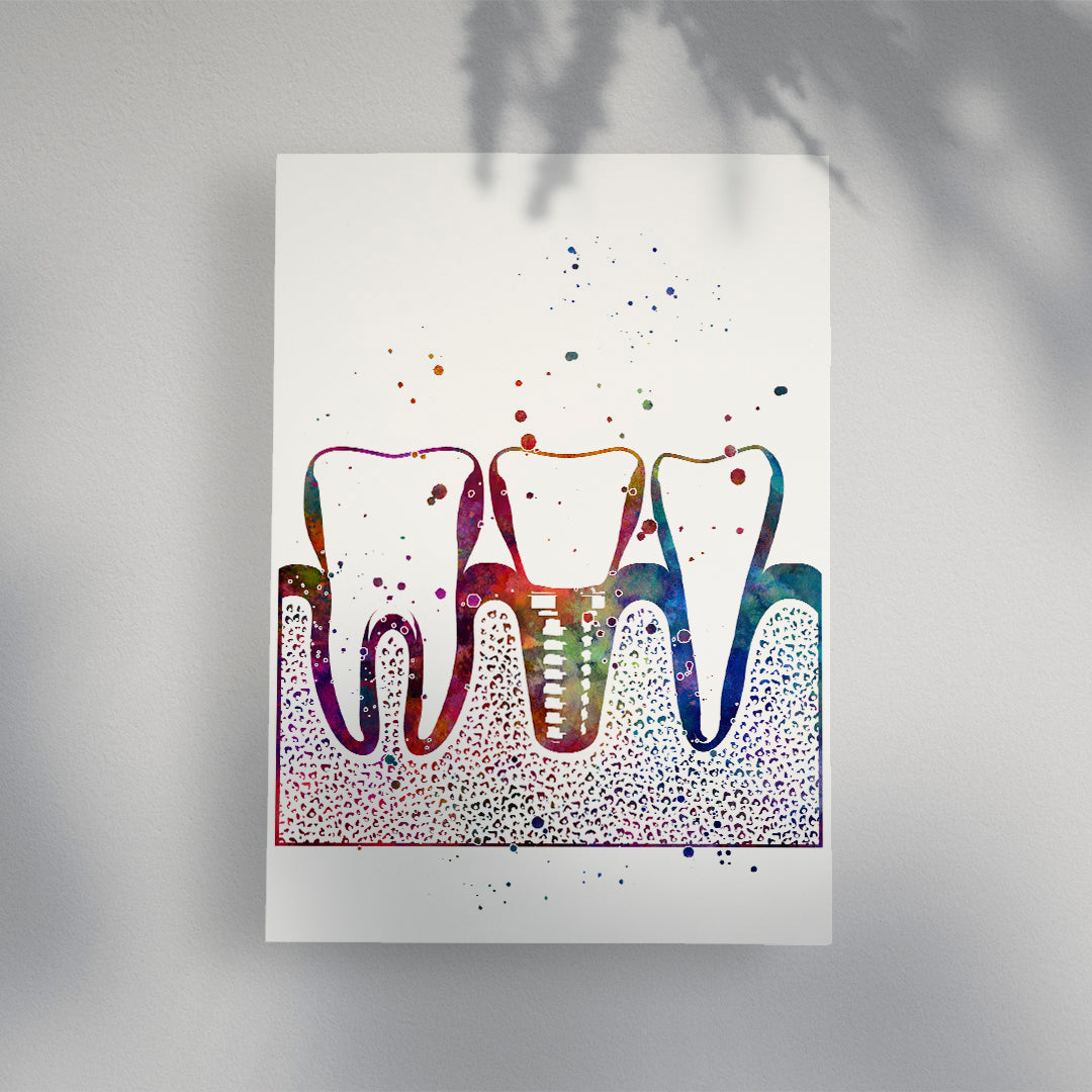 Vibrant teeth and dental implant watercolor artwork, great for dentist office decor.