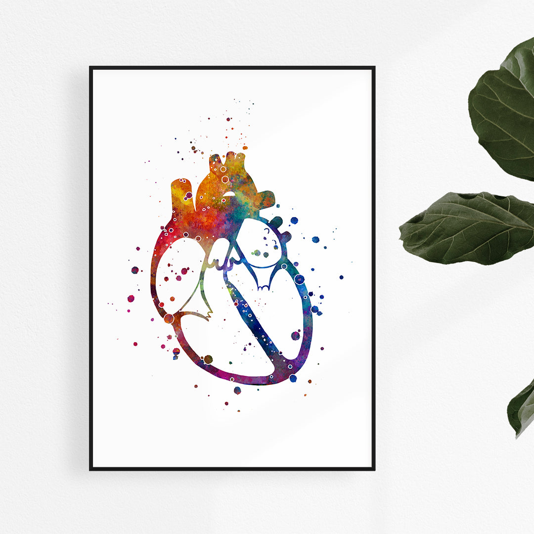 Dilated Cardiomyopathy art print in colorful watercolor design.