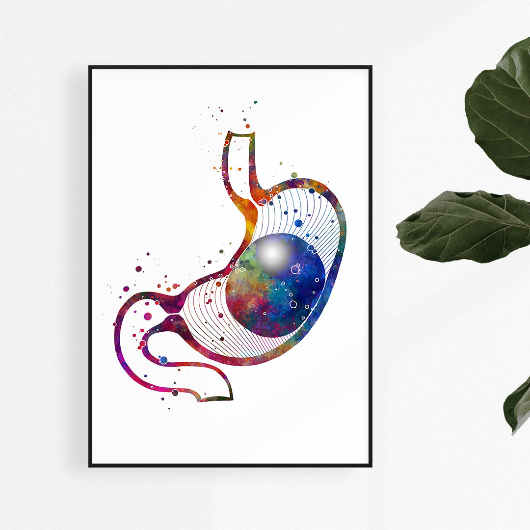 Intragastric Balloon for Weight Loss Watercolor Print, perfect for bariatric surgery offices.