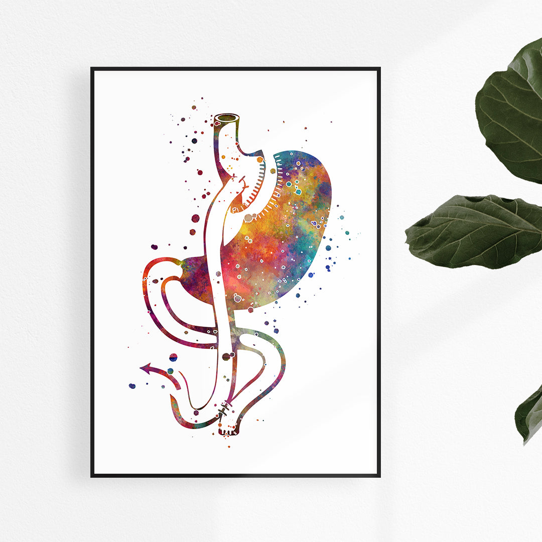 Gastric Bypass Surgery Watercolor Art Print for clinic wall art decoration, Surgeon Gift Idea