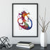 Colorful medical illustration of Hypoplastic Right Heart Syndrome.