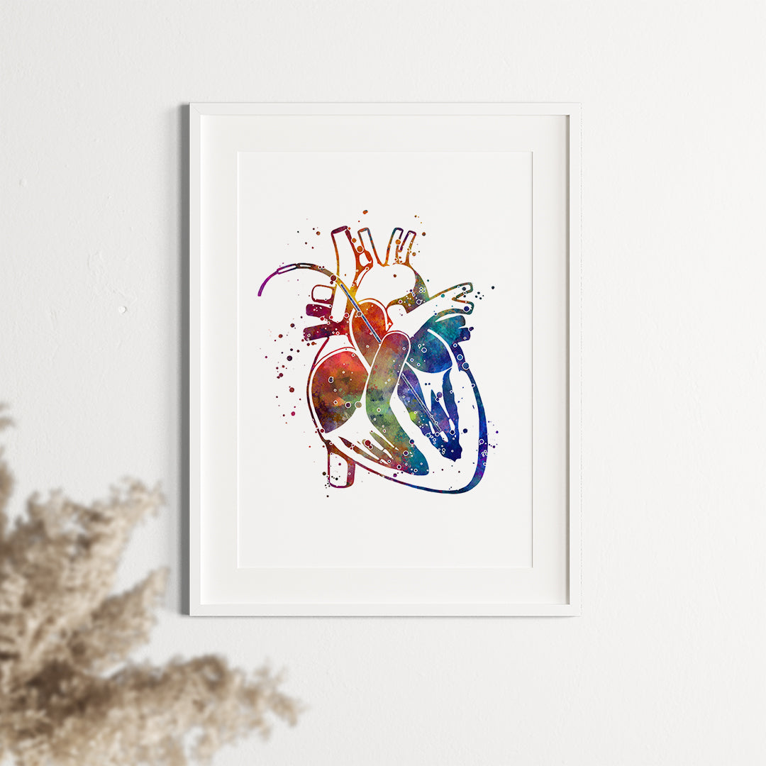 Watercolor Print Impella Heart Pump