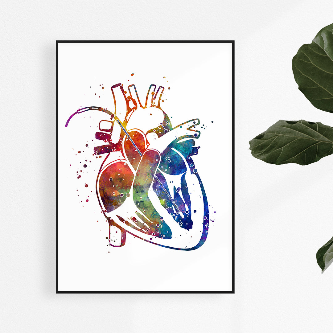 mpella heart pump watercolor art print for cardiology decor.