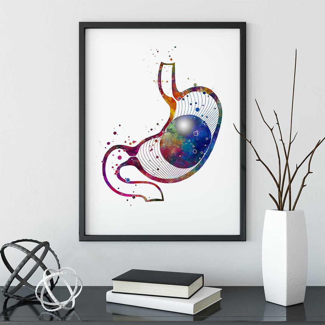 Intragastric Balloon for Weight Loss Watercolor Art Print