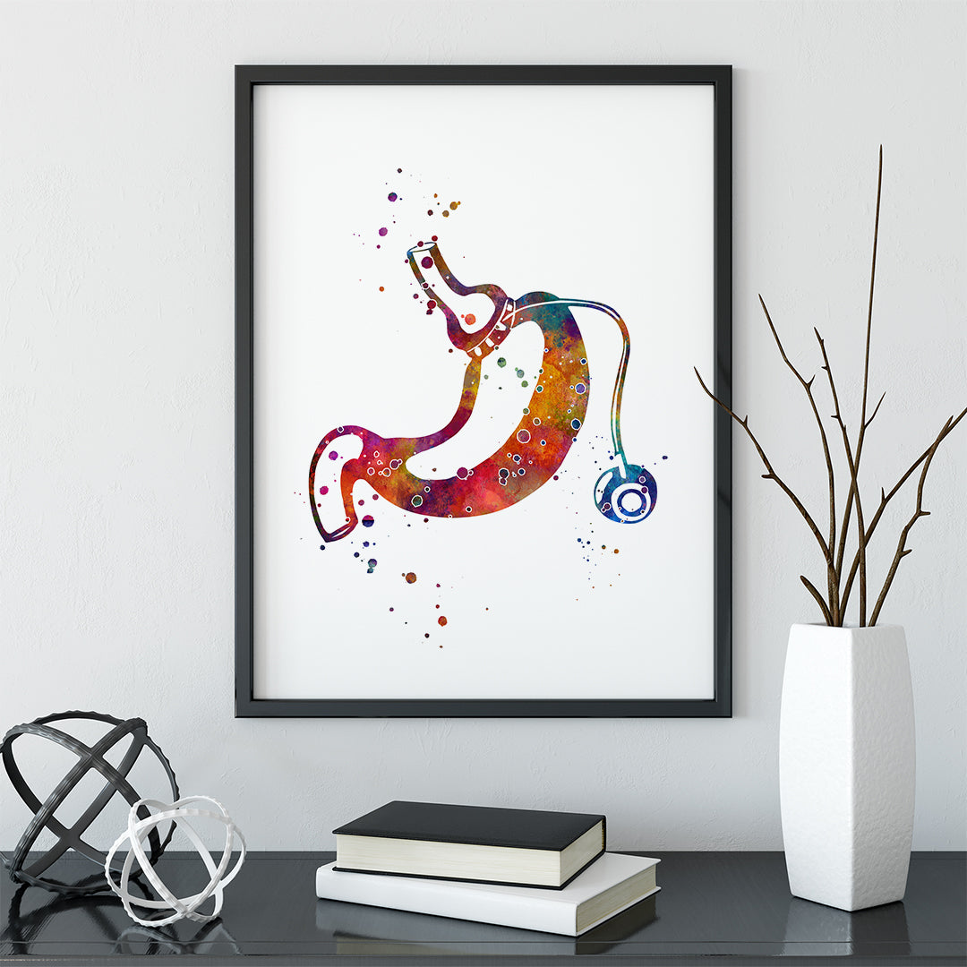 Gastric Band Bariatric Surgery Art Watercolor Print