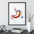 Gastric Band Bariatric Surgery Art Watercolor Print