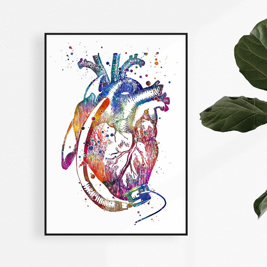 eart with LVAD implant surgery watercolor art print.