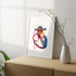 Hypoplastic left heart syndrome HLHS medical art print for clinic wall decor