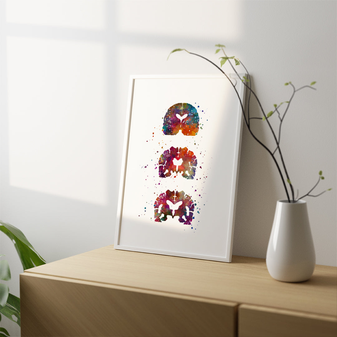 Unique watercolor artwork of Alzheimers Brain, a thoughtful gift for neurologists or memory care professionals.