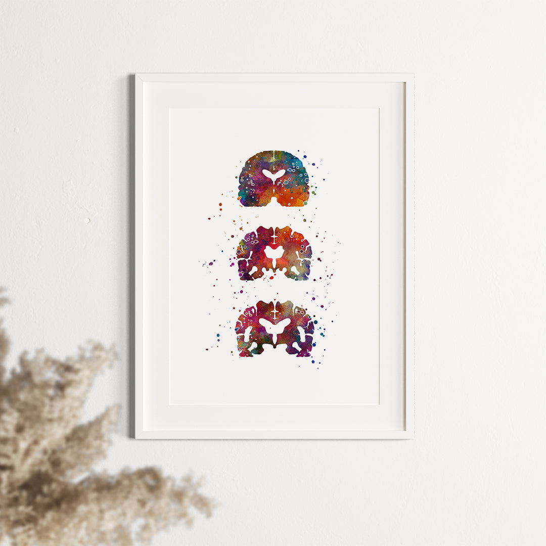 Alzheimers Brain Watercolor Art Print, detailed and colorful medical decor for neuroscience and neurology spaces