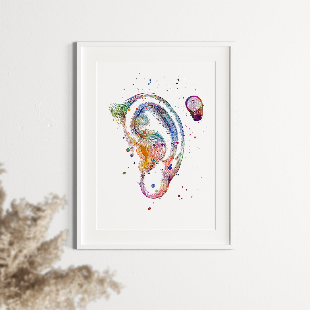 Bone Anchored Hearing Aid BAHA Watercolor Art Print