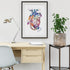 Heart with LVAD Watercolor Art Print