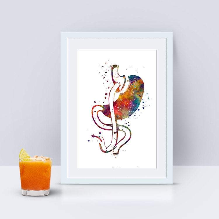 Gastric Bypass Surgery Watercolor Art Print