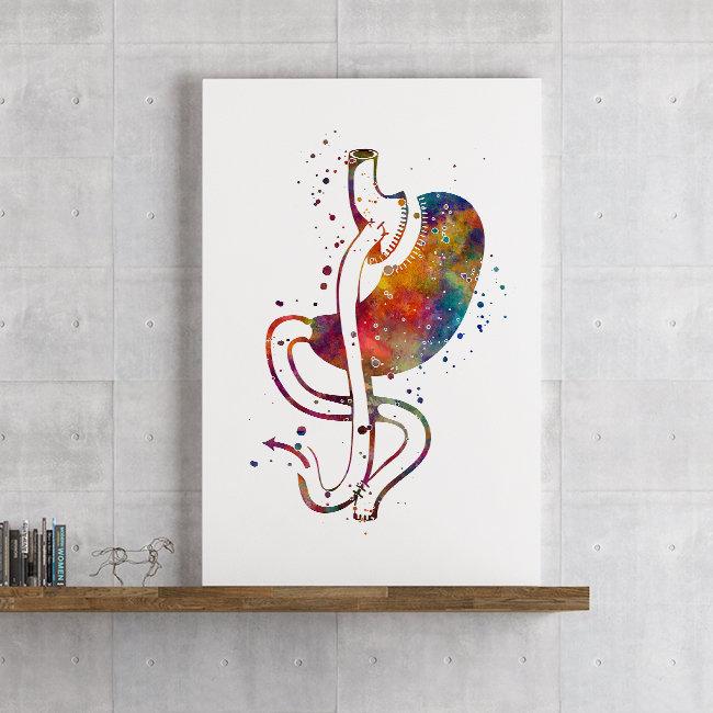Gastric Bypass Surgery Watercolor Art Print