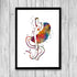 Gastric Bypass Surgery Watercolor Art Print