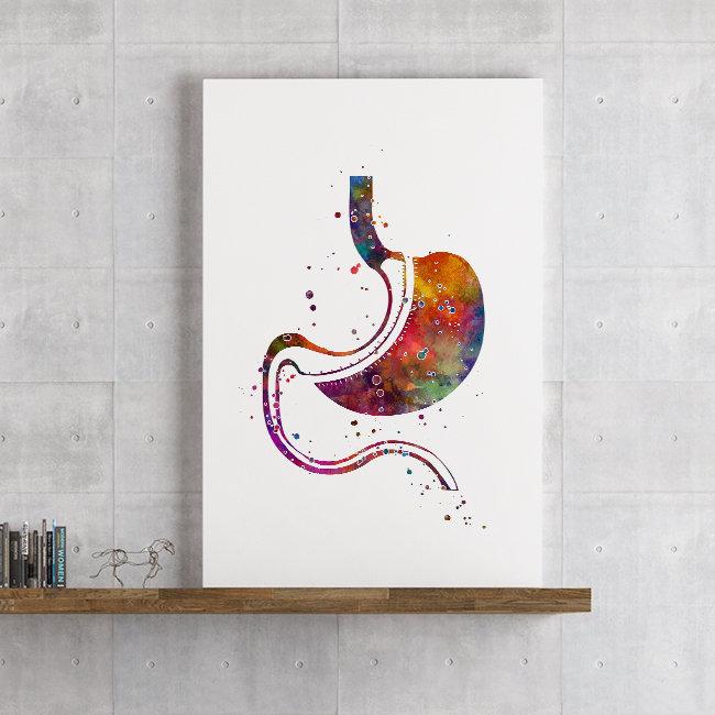 Gastric Sleeve Surgery Watercolor Art Print