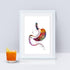 Gastric Sleeve Surgery Watercolor Art Print