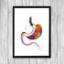 Gastric Sleeve Surgery Watercolor Art Print