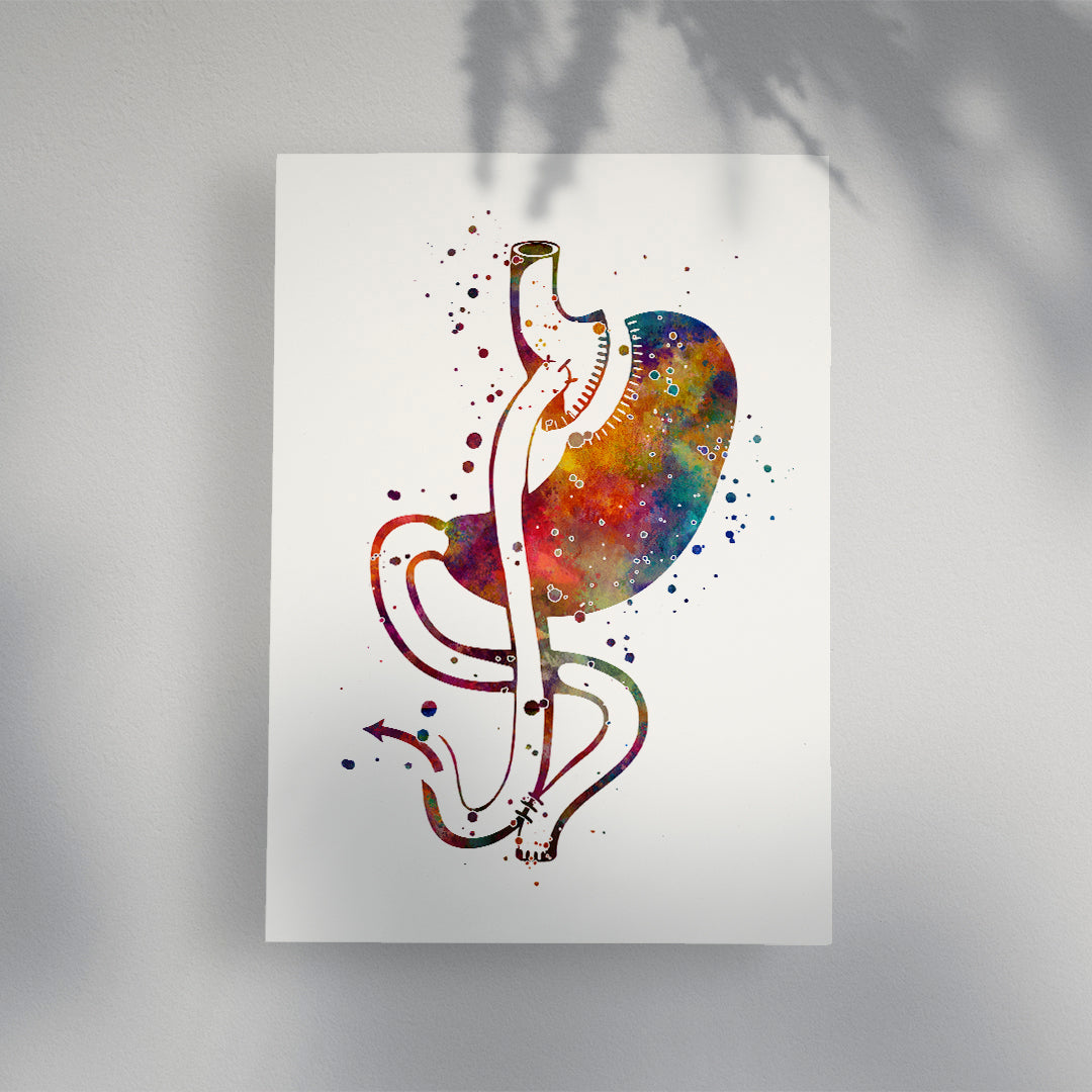 Gastric Bypass Surgery Watercolor Art Print