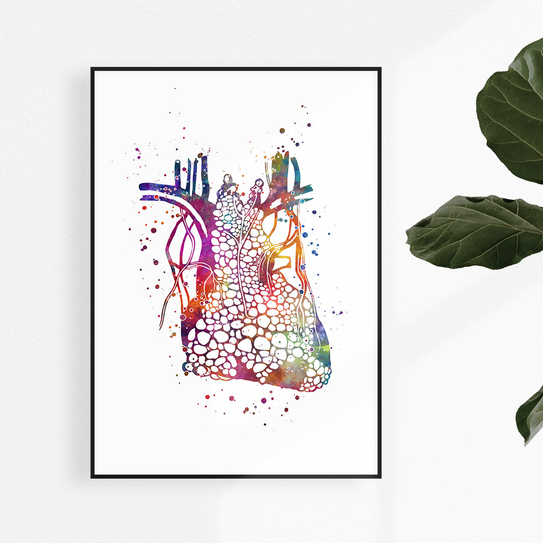 Surgical oncologists office decor, Heart Thymoma watercolor print