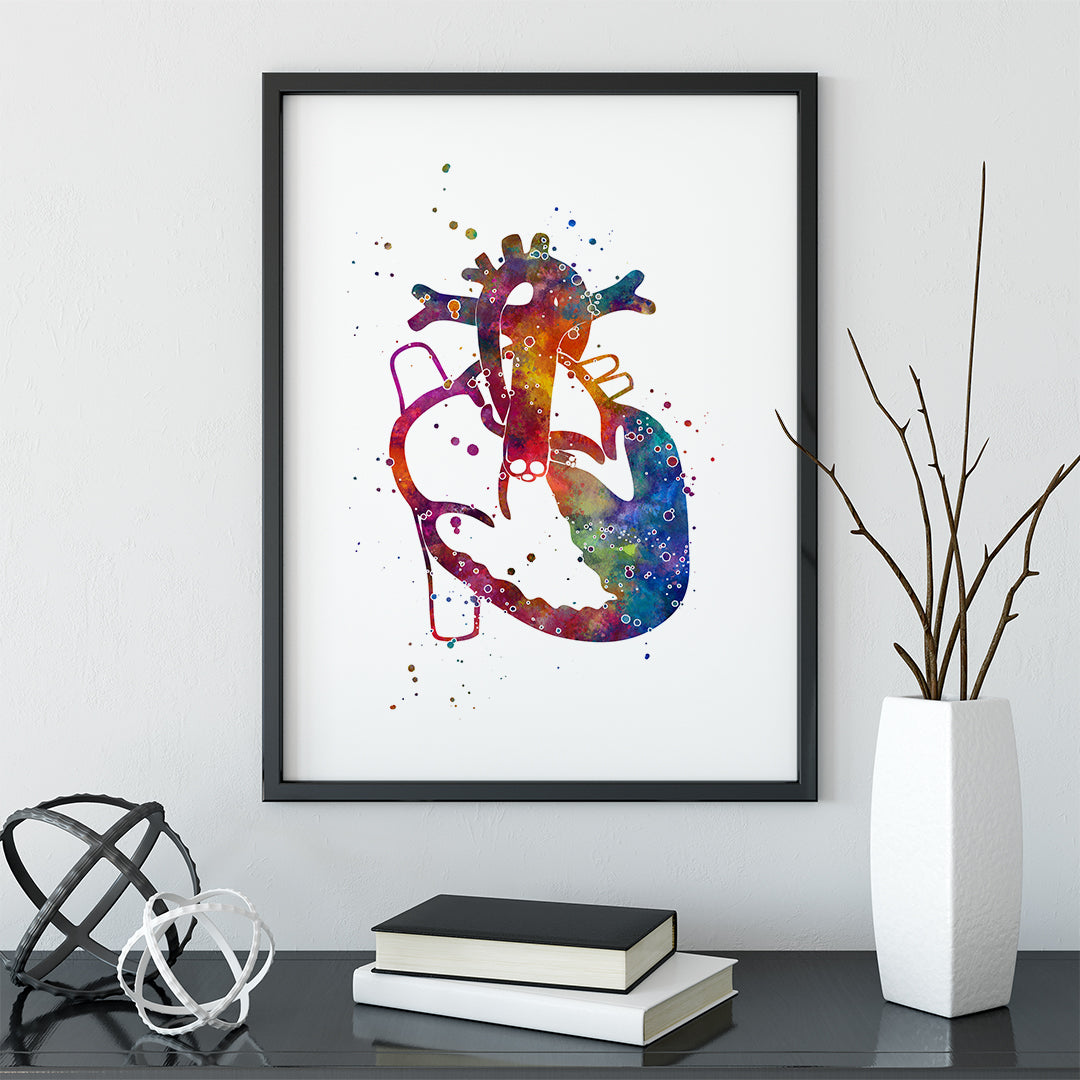 Hypoplastic left heart syndrome Medical poster, Multicolored picture, Wall decor for pediatric cardiologist office