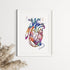 Heart with LVAD Watercolor Art Print