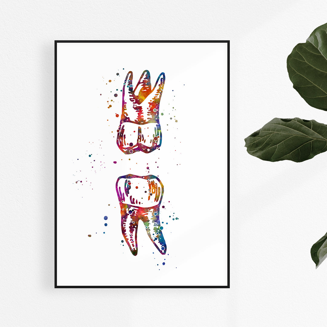 Maxillary and Mandibular Molar - Watercolor Print