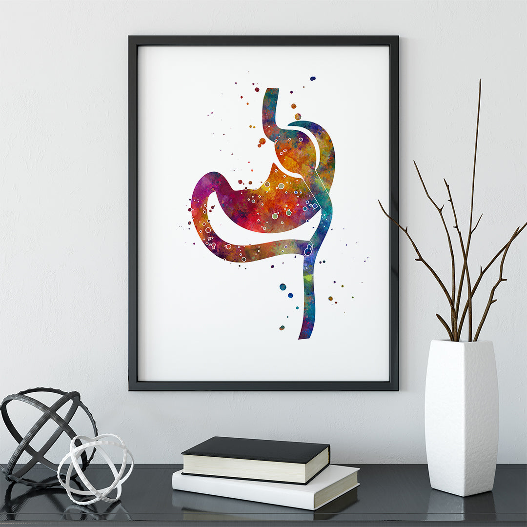 Weight-loss surgery art print featuring Roux-en-Y Gastric Bypass anatomy.