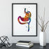 Weight-loss surgery art print featuring Roux-en-Y Gastric Bypass anatomy.