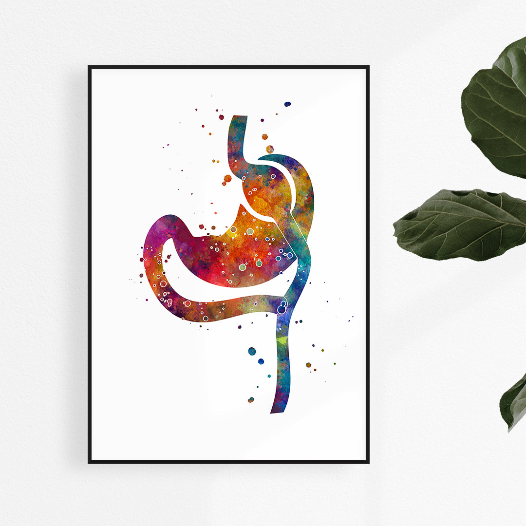 Roux-en-Y Gastric Bypass watercolor art print, perfect for bariatric surgery clinic decor.