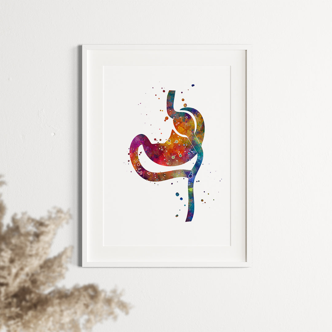 Vibrant watercolor art of Roux-en-Y Gastric Bypass, ideal for bariatric healthcare spaces.