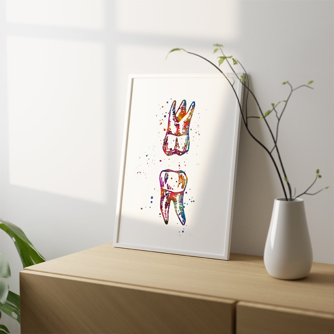 Maxillary and Mandibular Molar - Watercolor Print
