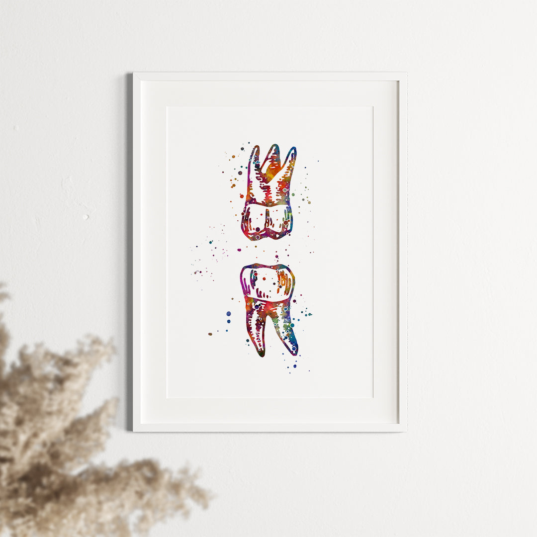 Maxillary and Mandibular Molar - Watercolor Print